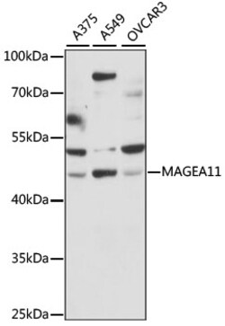 ABclonal Technology&nbsp;MAGEA11 Rabbit pAb