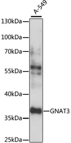 ABclonal Technology&nbsp;GNAT3 Rabbit pAb