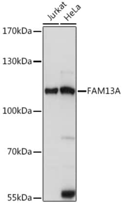 ABclonal Technology&nbsp;FAM13A Rabbit pAb