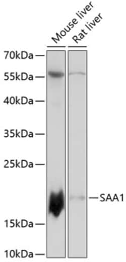 ABclonal Technology&nbsp;SAA1 Rabbit pAb