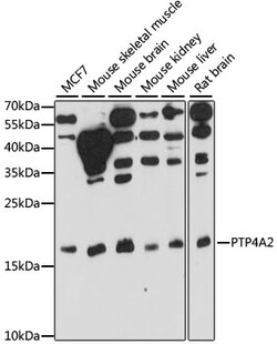 ABclonal Technology&nbsp;PTP4A2 Rabbit pAb