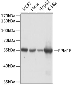 ABclonal Technology&nbsp;PPM1F Rabbit pAb