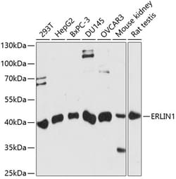 ABclonal Technology&nbsp;ERLIN1 Rabbit pAb