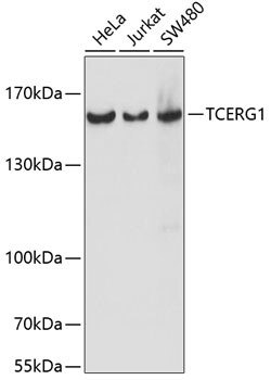 ABclonal Technology&nbsp;TCERG1 Rabbit pAb