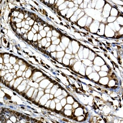 ABclonal Technology&nbsp;GLI3 Rabbit pAb