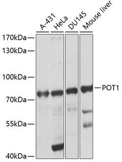 ABclonal Technology&nbsp;POT1 Rabbit pAb