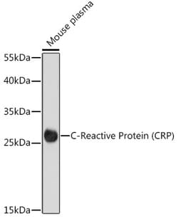 ABclonal Technology&nbsp;C-Reactive Protein (CRP) Rabbit pAb