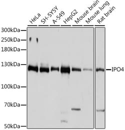 ABclonal Technology&nbsp;IPO4 Rabbit pAb