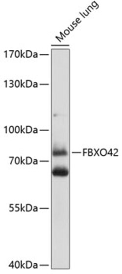 ABclonal Technology&nbsp;FBXO42 Rabbit pAb