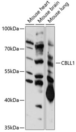 ABclonal Technology&nbsp;CBLL1 Rabbit pAb