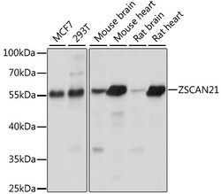 ABclonal Technology&nbsp;ZSCAN21 Rabbit pAb