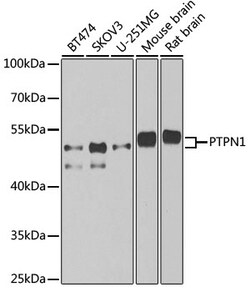 ABclonal Technology&nbsp;PTPN1 Rabbit pAb