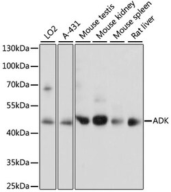 ABclonal Technology&nbsp;ADK Rabbit pAb