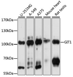 ABclonal Technology&nbsp;[KO Validated] GIT1 Rabbit pAb