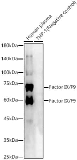 ABclonal Technology&nbsp;Factor IX / F9 Rabbit pAb