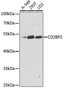 ABclonal Technology&nbsp;CD2BP2 Rabbit pAb