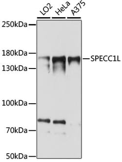 ABclonal Technology&nbsp;SPECC1L Rabbit pAb
