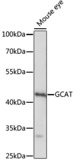 ABclonal Technology&nbsp;GCAT Rabbit pAb