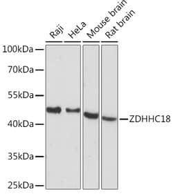 ABclonal Technology&nbsp;ZDHHC18 Rabbit pAb