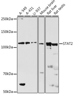 ABclonal Technology&nbsp;STAT2 Rabbit pAb