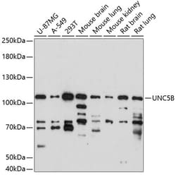 ABclonal Technology&nbsp;UNC5B Rabbit pAb