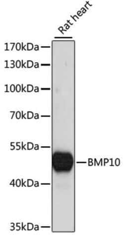 ABclonal Technology&nbsp;BMP10 Rabbit pAb