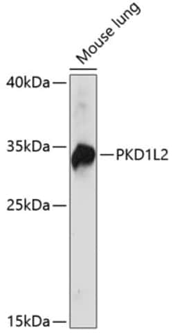 ABclonal Technology&nbsp;PKD1L2 Rabbit pAb
