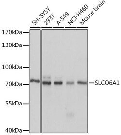 ABclonal Technology&nbsp;SLCO6A1 Rabbit pAb