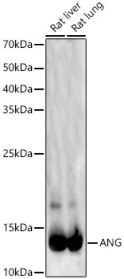 ABclonal Technology&nbsp;ANG Rabbit pAb