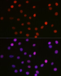 ABclonal Technology&nbsp;Acetyl-HMGB1-K29 Rabbit pAb