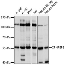 ABclonal Technology&nbsp;XPNPEP3 Rabbit pAb