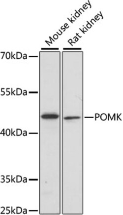 ABclonal Technology&nbsp;POMK Rabbit pAb