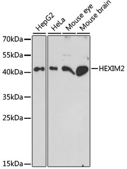 ABclonal Technology&nbsp;HEXIM2 Rabbit pAb