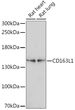 ABclonal Technology&nbsp;CD163L1 Rabbit pAb