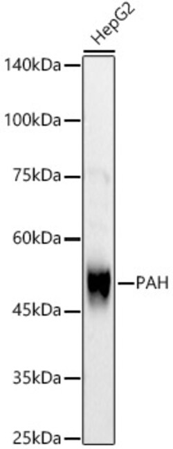 ABclonal Technology&nbsp;PAH Rabbit pAb