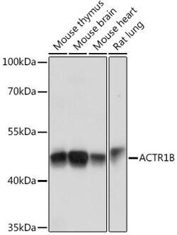 ABclonal Technology&nbsp;ACTR1B Rabbit pAb