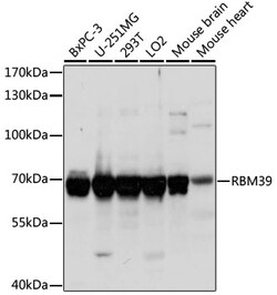 ABclonal Technology&nbsp;RBM39 Rabbit pAb