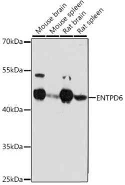 ABclonal Technology&nbsp;ENTPD6 Rabbit pAb