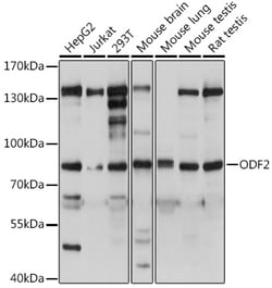 ABclonal Technology&nbsp;ODF2 Rabbit pAb