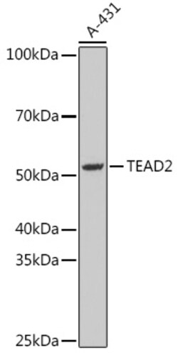 ABclonal Technology&nbsp;TEAD2 Rabbit pAb