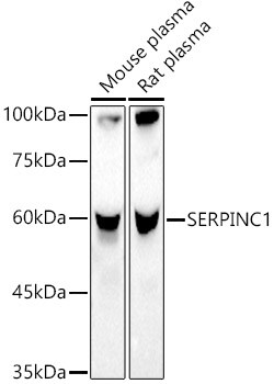 ABclonal Technology&nbsp;SERPINC1 Rabbit pAb