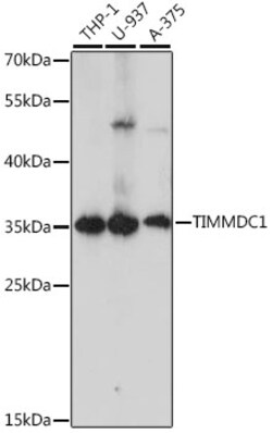 ABclonal Technology&nbsp;TIMMDC1 Rabbit pAb