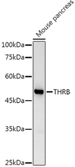 ABclonal Technology&nbsp;TRβ1/THRB Rabbit pAb