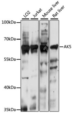 ABclonal Technology AK5 Rabbit pAb