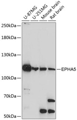 ABclonal Technology&nbsp;EPHA5 Rabbit pAb