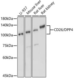 ABclonal Technology&nbsp;CD26/DPP4 Rabbit pAb