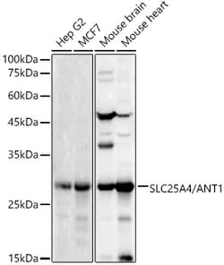 ABclonal Technology&nbsp;SLC25A4/ANT1 Rabbit pAb