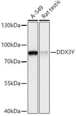 ABclonal Technology&nbsp;DDX3Y Rabbit pAb
