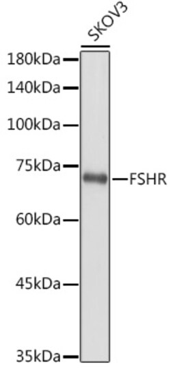 ABclonal Technology&nbsp;FSHR Rabbit pAb
