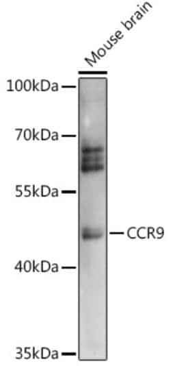 ABclonal Technology&nbsp;CCR9 Rabbit pAb